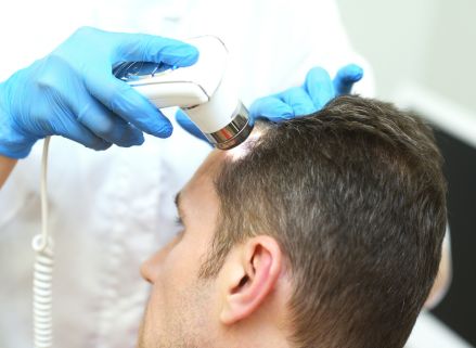 Nhổ tóc bạc công nghệ